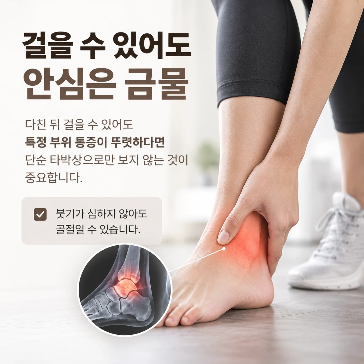 걸을 수 있어도 국소 통증이 남는 하지 외상