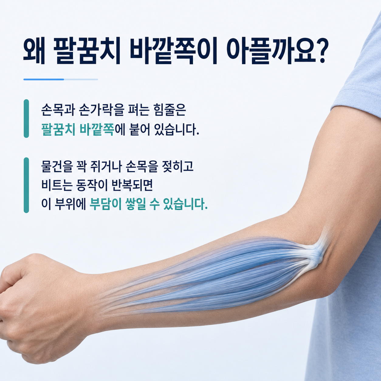 팔꿈치 바깥쪽 손목 폄근 힘줄 구조
