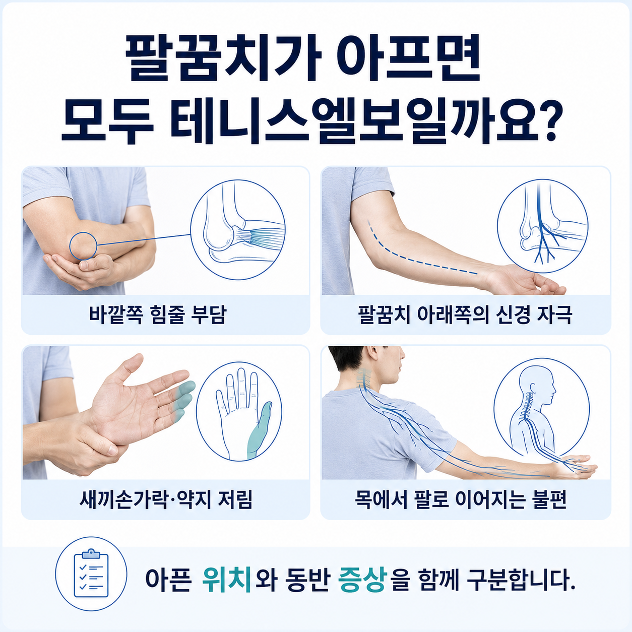 팔꿈치 바깥쪽 통증과 신경 증상 감별