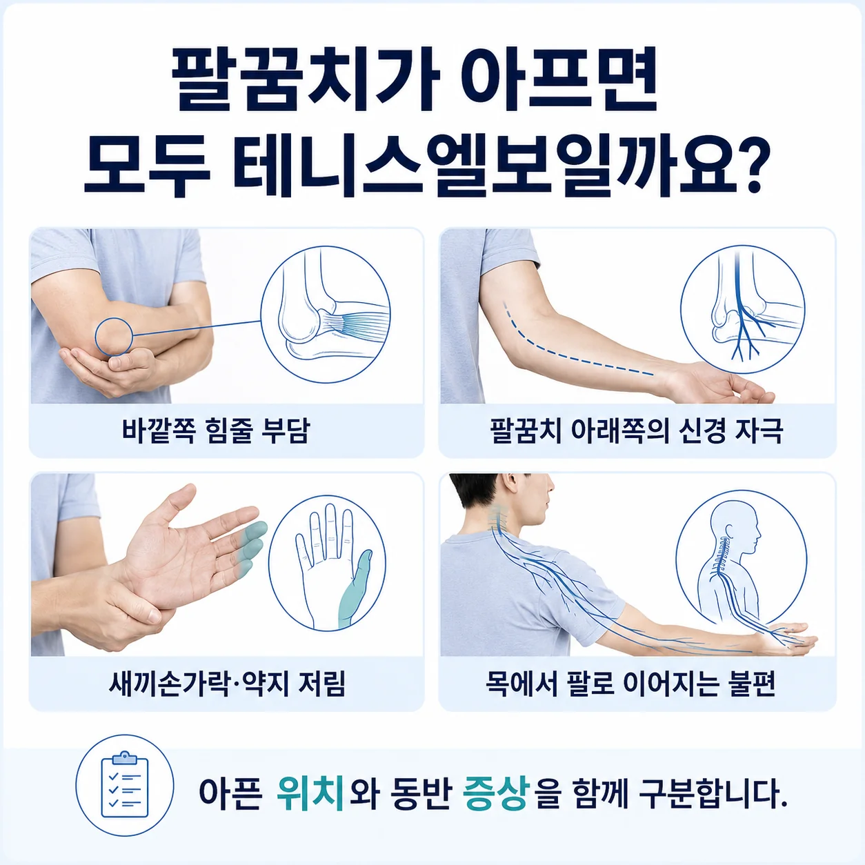 팔꿈치 바깥쪽 통증과 신경 증상 감별