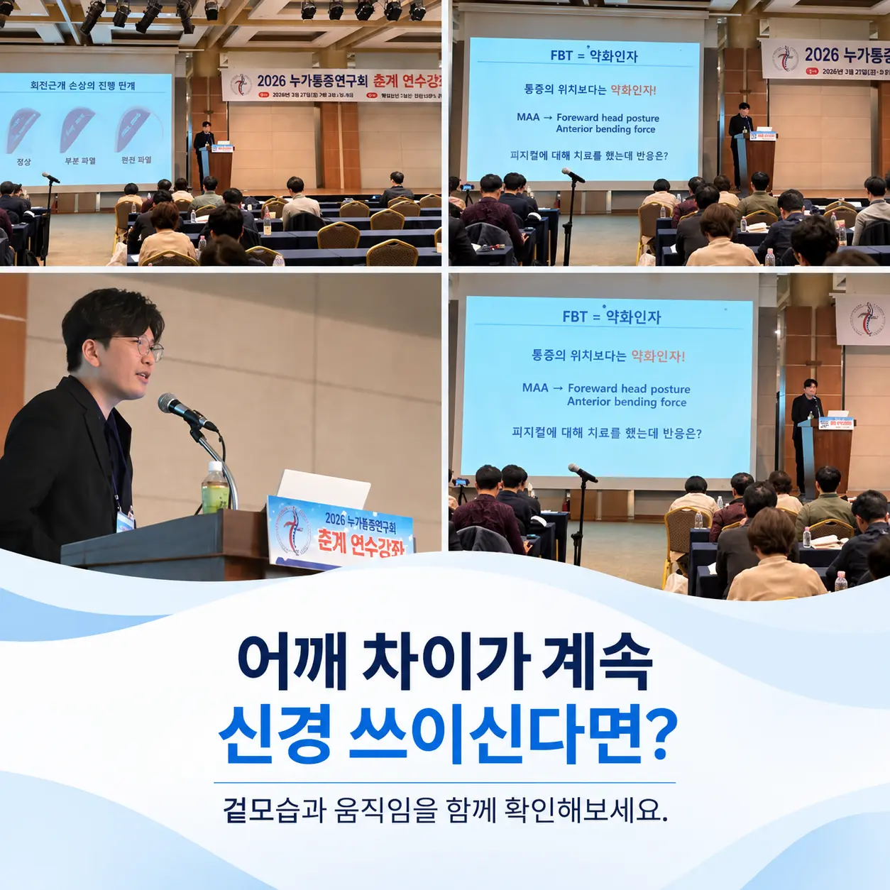서울성모정형외과 김동진 원장의 어깨 높이 차이 안내