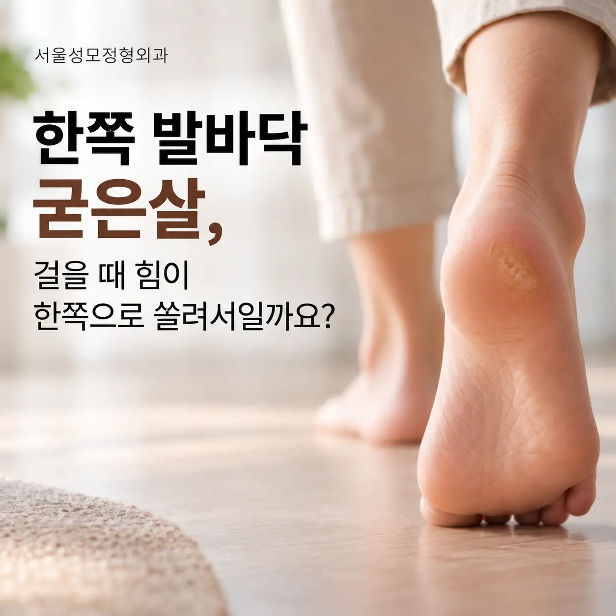 한쪽 발바닥 굳은살과 걸을 때 압력 집중